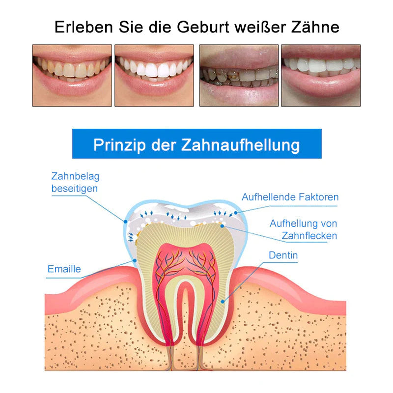 🔥Lápiz para limpieza y blanqueamiento dental