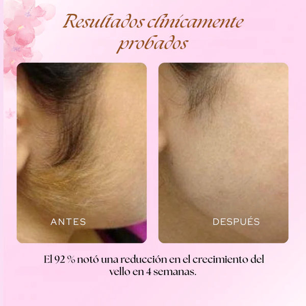 ✨ Aceite de Cyperus Rotundus  para la reducción permanente y natural del vello