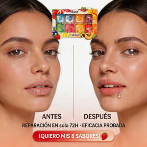 Set 8 Bálsamos: 2 Años de Hidratación (Huelen Increíble) 🍓✨
